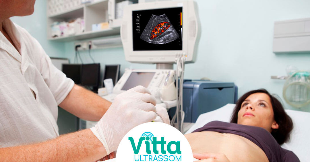 Ultrassom com Doppler Colorido: o que é e para que serve?